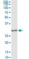 Homeobox C6 antibody, H00003223-M04, Novus Biologicals, Western Blot image 