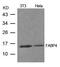 Fatty Acid Binding Protein 4 antibody, GTX50771, GeneTex, Western Blot image 