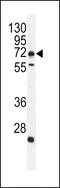 Growth Differentiation Factor 15 antibody, 56-032, ProSci, Western Blot image 