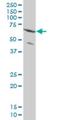 Zinc Finger Protein 133 antibody, H00007692-M01, Novus Biologicals, Western Blot image 