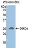 ADAM Metallopeptidase With Thrombospondin Type 1 Motif 1 antibody, LS-C299901, Lifespan Biosciences, Western Blot image 