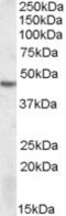 Serine/Threonine Kinase 17b antibody, EB09400, Everest Biotech, Western Blot image 