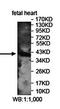 Ankyrin Repeat And SOCS Box Containing 4 antibody, orb78457, Biorbyt, Western Blot image 
