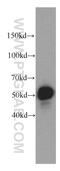 Zinc Finger Protein 622 antibody, 20804-1-AP, Proteintech Group, Western Blot image 