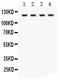 Solute Carrier Family 12 Member 1 antibody, PA5-80003, Invitrogen Antibodies, Western Blot image 