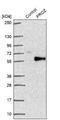 Hemoglobin subunit beta-H1 antibody, NBP2-49030, Novus Biologicals, Western Blot image 