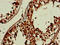DEP Domain Containing 1B antibody, LS-C674693, Lifespan Biosciences, Immunohistochemistry paraffin image 