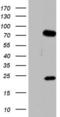 Protein Phosphatase 2 Regulatory Subunit B'Delta antibody, LS-C790149, Lifespan Biosciences, Western Blot image 