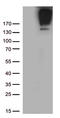 ATP Binding Cassette Subfamily B Member 1 antibody, TA801049, Origene, Western Blot image 