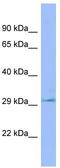 Phospholysine Phosphohistidine Inorganic Pyrophosphate Phosphatase antibody, TA344694, Origene, Western Blot image 