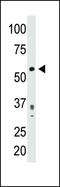 Pyruvate Dehydrogenase Complex Component X antibody, PA5-11896, Invitrogen Antibodies, Western Blot image 