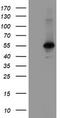 Meis Homeobox 3 antibody, TA800232BM, Origene, Western Blot image 
