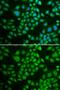 Deoxycytidine Kinase antibody, GTX32553, GeneTex, Immunofluorescence image 