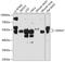 DEAD-Box Helicase 47 antibody, A10273, Boster Biological Technology, Western Blot image 