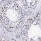 Methyl-CpG Binding Protein 2 antibody, NBP1-81027, Novus Biologicals, Immunohistochemistry paraffin image 
