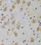 Insulin Like Growth Factor Binding Protein 4 antibody, FNab04179, FineTest, Immunohistochemistry frozen image 