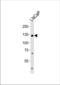 Transient Receptor Potential Cation Channel Subfamily M Member 8 antibody, TA324432, Origene, Western Blot image 