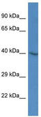 SH3 Domain Containing GRB2 Like 3, Endophilin A3 antibody, TA342209, Origene, Western Blot image 