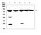 G Protein-Coupled Receptor Kinase 2 antibody, A01473-1, Boster Biological Technology, Western Blot image 