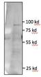 Toll Like Receptor 5 antibody, TA336873, Origene, Western Blot image 