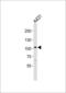 Collagen Type VI Alpha 1 Chain antibody, GTX81823, GeneTex, Western Blot image 