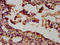 Unc-5 Netrin Receptor B antibody, LS-C674559, Lifespan Biosciences, Immunohistochemistry paraffin image 