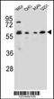 Centrosomal Protein 70 antibody, 55-310, ProSci, Western Blot image 