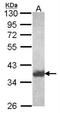 Aldo-Keto Reductase Family 1 Member C4 antibody, NBP2-14989, Novus Biologicals, Western Blot image 