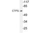 CTP Synthase 1 antibody, LS-C177243, Lifespan Biosciences, Western Blot image 