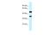 Retinol dehydrogenase 13 antibody, A12202, Boster Biological Technology, Western Blot image 