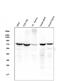 Zeta Chain Of T Cell Receptor Associated Protein Kinase 70 antibody, M00754-5, Boster Biological Technology, Western Blot image 