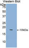 Lymphocyte Antigen 96 antibody, LS-C295214, Lifespan Biosciences, Western Blot image 