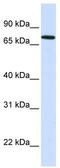 SET Domain Bifurcated Histone Lysine Methyltransferase 2 antibody, TA346848, Origene, Western Blot image 