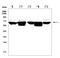 DEAD-Box Helicase 5 antibody, A00670, Boster Biological Technology, Western Blot image 