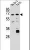 Carboxylesterase 4A antibody, LS-C203652, Lifespan Biosciences, Western Blot image 