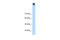 Transient Receptor Potential Cation Channel Subfamily M Member 3 antibody, 28-318, ProSci, Western Blot image 