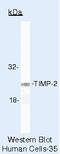 TIMP Metallopeptidase Inhibitor 2 antibody, MA5-12204, Invitrogen Antibodies, Western Blot image 