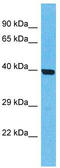 Olfactory Receptor Family 5 Subfamily T Member 2 antibody, TA337524, Origene, Western Blot image 