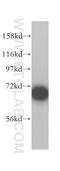 Ribosomal Protein S6 Kinase B1 antibody, 14485-1-AP, Proteintech Group, Western Blot image 
