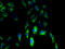Clarin 3 antibody, A66218-100, Epigentek, Immunofluorescence image 