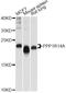 Protein Phosphatase 1 Regulatory Inhibitor Subunit 14A antibody, A10160, ABclonal Technology, Western Blot image 