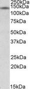 Nuclear Receptor Interacting Protein 1 antibody, LS-C102876, Lifespan Biosciences, Western Blot image 