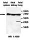 Zinc Finger And BTB Domain Containing 22 antibody, orb77690, Biorbyt, Western Blot image 