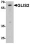 GLIS Family Zinc Finger 2 antibody, A07390, Boster Biological Technology, Western Blot image 