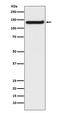 Toll Like Receptor 9 antibody, M00198, Boster Biological Technology, Western Blot image 