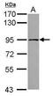 Threonyl-TRNA Synthetase 2, Mitochondrial antibody, GTX120121, GeneTex, Western Blot image 