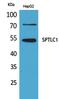 SPTLC1 antibody, PA5-51091, Invitrogen Antibodies, Western Blot image 