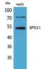 Serine Palmitoyltransferase Long Chain Base Subunit 1 antibody, PA5-51091, Invitrogen Antibodies, Western Blot image 