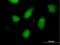 Regulator Of Solute Carriers 1 antibody, H00006248-B01P, Novus Biologicals, Immunocytochemistry image 