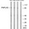 Patatin Like Phospholipase Domain Containing 8 antibody, A08992, Boster Biological Technology, Western Blot image 